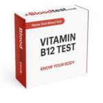 B12 Deficiency Blood Test: What to Expect in Portsmouth