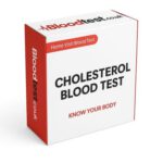 Cholesterol Blood Test Now Offered in Chelmsford